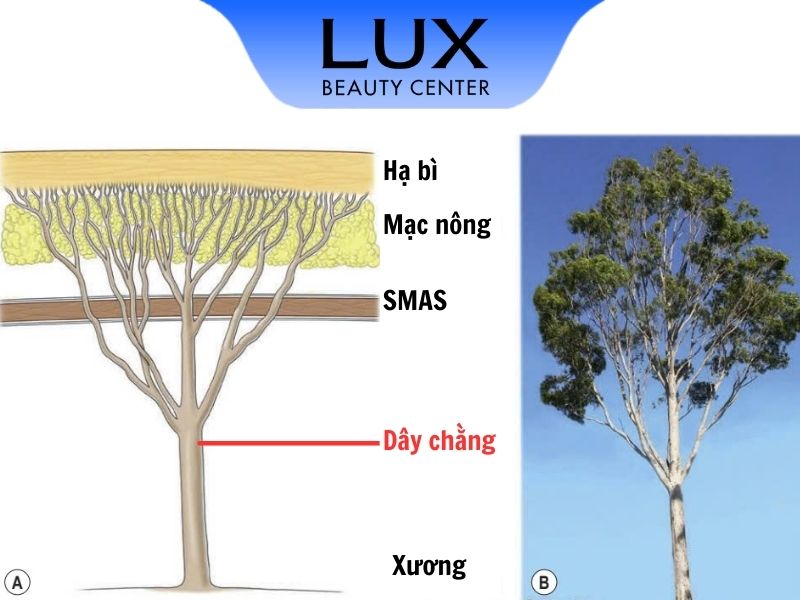 cây dây chằng - Image 2